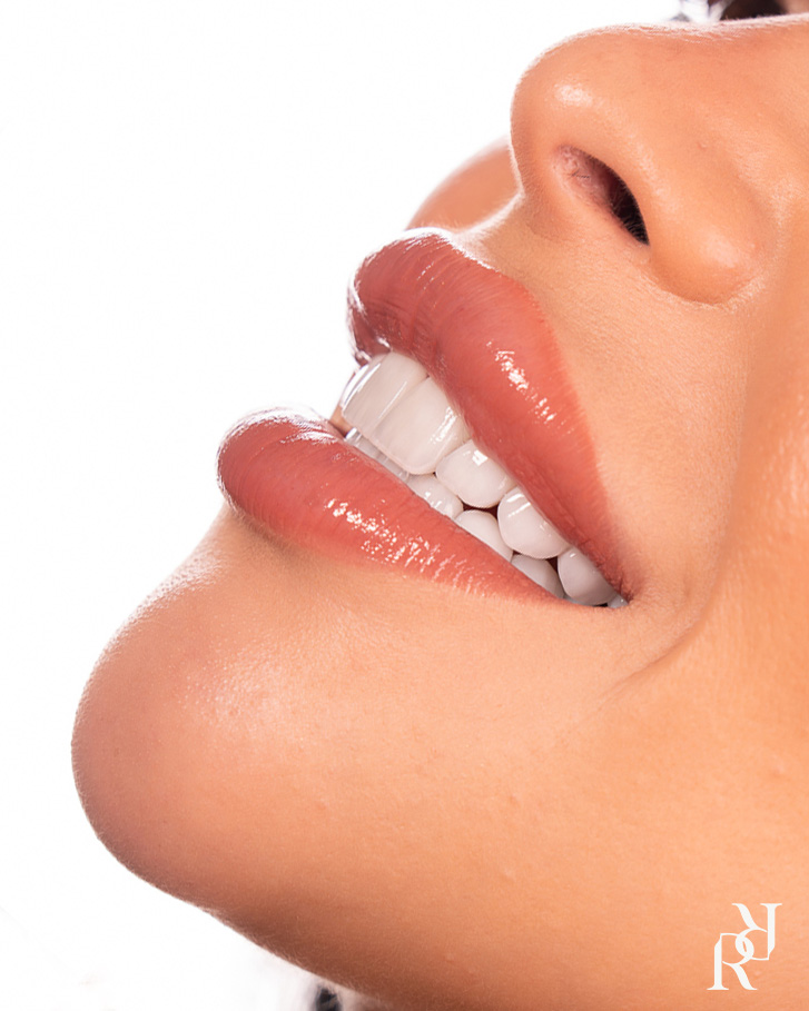 Full mouth smile reconstruction patient portrait